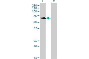 Western Blot analysis of TBX5 expression in transfected 293T cell line by TBX5 monoclonal antibody (M01), clone 1G10. (T-Box 5 antibody  (AA 402-518))