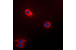 Immunofluorescent analysis of CD174 staining in Raw264. (FUT3 antibody  (Center))