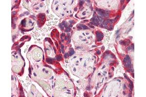 Anti-IDS antibody IHC of human placenta. (IDS antibody  (AA 440-451))