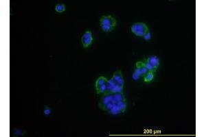 Immunofluorescence of monoclonal antibody to CD276 on MCF-7 cell . (CD276 antibody  (AA 28-238))