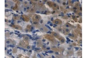 DAB staining on IHC-P; Samples: Human Stomach Tissue (RNASE3 antibody  (AA 30-154))