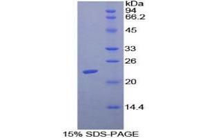 SDS-PAGE analysis of Mouse ADCYAP1 Protein.