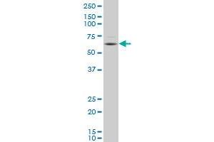 DPYSL4 polyclonal antibody (A01), Lot # 051206JCO1 Western Blot analysis of DPYSL4 expression in IMR-32 . (DPYSL4 antibody  (AA 461-559))