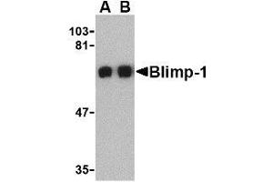 Western blot analysis of Blimp-1 in A549 cell lysate with AP30154PU-N Blimp-1 antibody at (A) 0. (PRDM1 antibody  (C-Term))