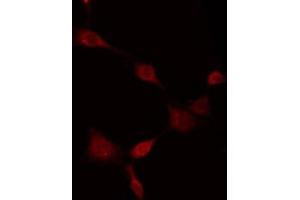ABIN6275281 staining HT29 by IF/ICC. (MT-ND5 antibody  (Internal Region))
