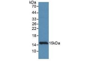 Detection of Recombinant CCDC60, Rat using Monoclonal Antibody to Coiled Coil Domain Containing Protein 60 (CCDC60) (CCDC60 antibody  (AA 127-236))