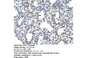 Rabbit Anti-FUSIP1 Antibody  Paraffin Embedded Tissue: Human Lung Cellular Data: Alveolar cells Antibody Concentration: 4. (SRSF10 antibody  (C-Term))