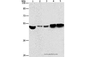 Western blot analysis of Hela and A431 cell, mouse brain and liver tissue, mouse pancreas tissue, using ENO1 Polyclonal Antibody at dilution of 1:500 (ENO1 antibody)