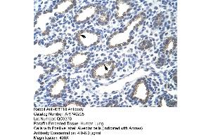 Rabbit Anti-KRT18 Antibody  Paraffin Embedded Tissue: Human Lung Cellular Data: Alveolar cells Antibody Concentration: 4. (Cytokeratin 18 antibody  (N-Term))