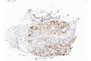 Immunohistochemistry with rat sensory ganglia tissue (TRPA1 antibody  (Middle Region))