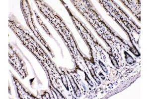 Immunohistochemistry (IHC) image for anti-High Mobility Group Box 1 (HMGB1) (AA 124-154) antibody (ABIN5647575)