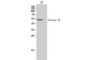 Western Blotting (WB) image for anti-Coronin, Actin Binding Protein, 1A (CORO1A) (Internal Region) antibody (ABIN3174518) (Coronin 1a antibody  (Internal Region))