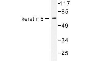 Image no. 1 for anti-Keratin 5 (KRT5) antibody (ABIN265501) (Cytokeratin 5 antibody)