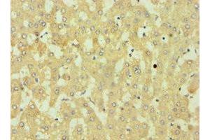 Immunohistochemistry of paraffin-embedded human liver tissue using ABIN7149891 at dilution of 1:100 (DKK4 antibody  (AA 19-224))