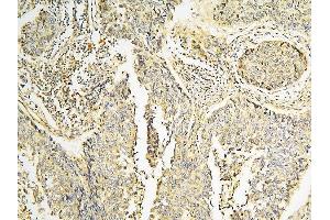 IHC analysis of CPAMD8 using anti-CPAMD8 antibody (ABIN6719649). (CPAMD8 antibody  (AA 58-234))