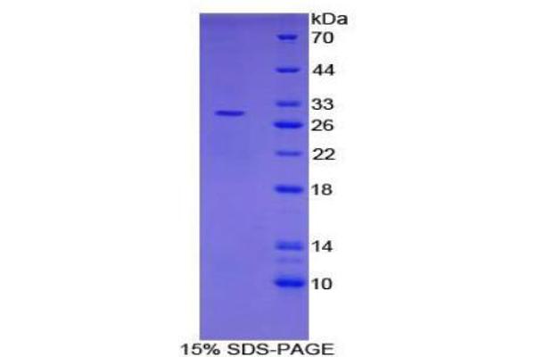 PIAS1 Protein
