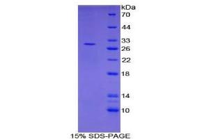 SDS-PAGE analysis of Human PIAS1 Protein.
