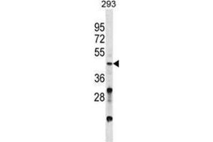 VSX2 Antibody (C-term) western blot analysis in 293 cell line lysates (35 µg/lane). (VSX2 antibody  (C-Term))
