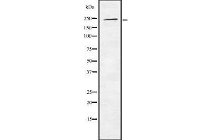 Western blot analysis of WNK2 using Jurkat whole cell lysates (WNK2 antibody  (Internal Region))