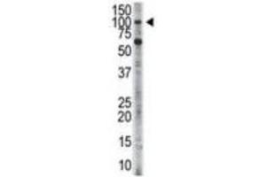 Western Blotting (WB) image for anti-Hexokinase 3 (White Cell) (HK3) antibody (ABIN3003707) (HK3 antibody)