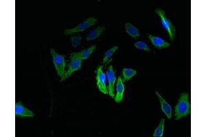 Immunofluorescent analysis of HepG2 cells using ABIN7171996 at dilution of 1:100 and Alexa Fluor 488-congugated AffiniPure Goat Anti-Rabbit IgG(H+L) (TXNDC11 antibody  (AA 656-985))