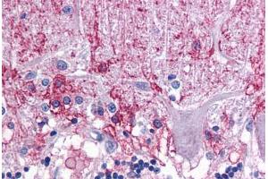 Human Brain, Cerebellum: Formalin-Fixed, Paraffin-Embedded (FFPE) (KPNA3 antibody  (C-Term))