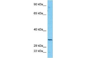 Host:  Rabbit  Target Name:  CBR3  Sample Type:  COLO205 Whole Cell lysates  Antibody Dilution:  1. (CBR3 antibody  (Middle Region))
