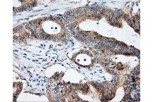 Immunohistochemical staining of paraffin-embedded Kidney tissue using anti-NME4 mouse monoclonal antibody. (NME4 antibody)
