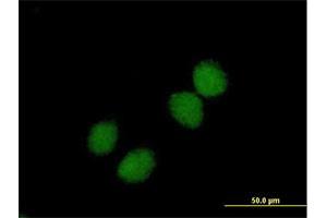 Immunofluorescence of purified MaxPab antibody to CHKB on HeLa cell. (CHKB antibody  (AA 1-395))