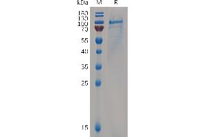 CD93 (CD93) (AA 22-580) protein (His tag)