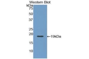 Western Blotting (WB) image for anti-Angiopoietin 1 (ANGPT1) (AA 284-452) antibody (ABIN5662020) (Angiopoietin 1 antibody  (AA 284-452))