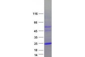 Validation with Western Blot