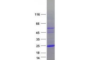 Validation with Western Blot (LAGE3 Protein (Myc-DYKDDDDK Tag))