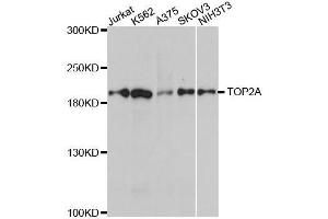 Western blot analysis of extracts of various cell lines, using TOP2A antibody. (Topoisomerase II alpha antibody)
