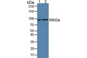 Figure. (Fibulin 1 antibody  (AA 176-398))