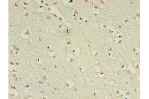 Immunohistochemistry (IHC) image for anti-gamma-aminobutyric Acid (GABA) A Receptor, alpha 4 (GABRA4) (AA 36-258) antibody (ABIN7153483)
