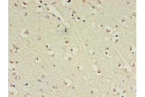 Immunohistochemistry of paraffin-embedded human brain tissue using ABIN7153483 at dilution of 1:100 (GABRA4 antibody  (AA 36-258))