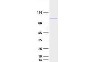 Validation with Western Blot (RFX2 Protein (Transcript Variant 1) (Myc-DYKDDDDK Tag))