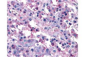 Anti-VIPR1 / RDC1 antibody IHC of human adrenal. (VIPR1 antibody  (Cytoplasmic Domain))