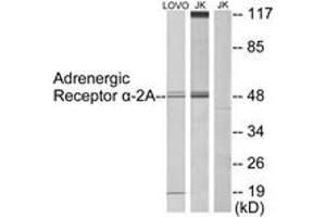 Western blot analysis of extracts from Jurkat/LOVO cells, using Adrenergic Receptor alpha-2A Antibody.