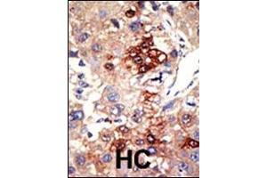 Immunohistochemistry (Paraffin-embedded Sections) (IHC (p)) image for anti-Enhancer of Zeste Homolog 2 (EZH2) (AA 410-440) antibody (ABIN6244310)