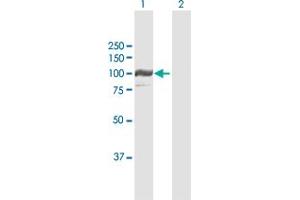 Western Blot analysis of PYGL expression in transfected 293T cell line by PYGL MaxPab polyclonal antibody. (PYGL antibody  (AA 1-847))