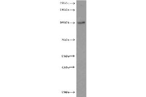 Western Blotting (WB) image for anti-Luteinizing Hormone/Choriogonadotropin Receptor (LHCGR) antibody (ABIN2937954) (LHCGR antibody)
