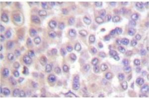 Image no. 1 for anti-Phospholipase A2, Group IVB (Cytosolic) (PLA2G4B) antibody (ABIN271921) (PLA2G4B antibody)