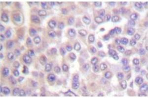 Image no. 1 for anti-Phospholipase A2, Group IVB (Cytosolic) (PLA2G4B) antibody (ABIN271921) (PLA2G4B antibody)
