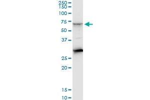 CTNS monoclonal antibody (M09), clone 5G6. (CTNS antibody  (AA 1-100))
