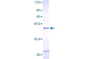 MGST1 Protein (AA 1-155) (GST tag)