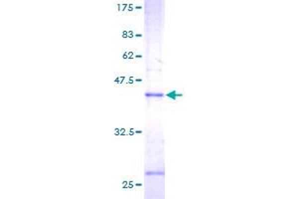 MGST1 Protein (AA 1-155) (GST tag)