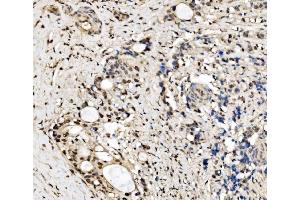 IHC analysis of CPSF6 using anti-CPSF6 antibody (ABIN7601898).