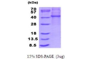 SDS-PAGE (SDS) image for Kelch Domain Containing 8B (KLHDC8B) (AA 1-354) protein (His tag) (ABIN5853945)